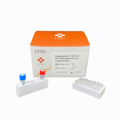 Le kit rapide d'essai de l'entérovirus 71 d'ACP de droite a lyophilisé le kit de détection d'ADN